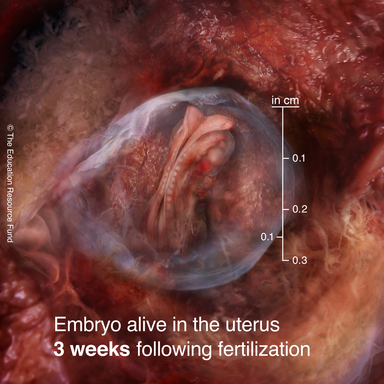 Embryo alive in the uterus 3 weeks following fertilization