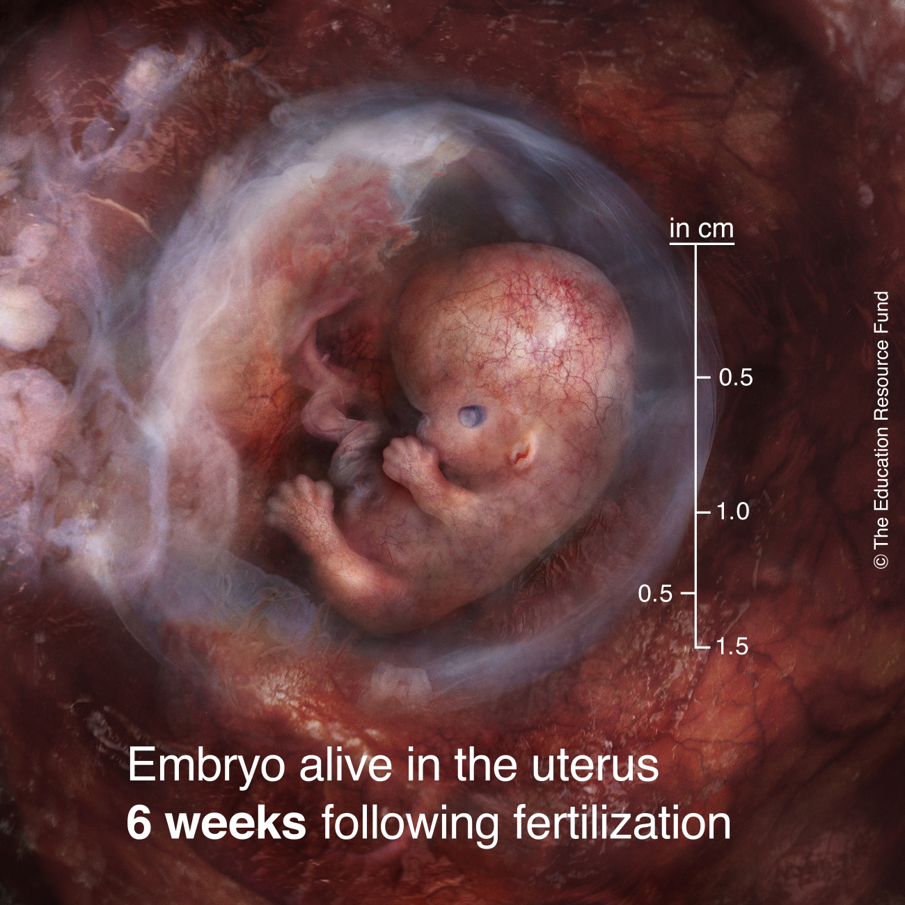 Embryo alive in the uterus 6 weeks following fertilization