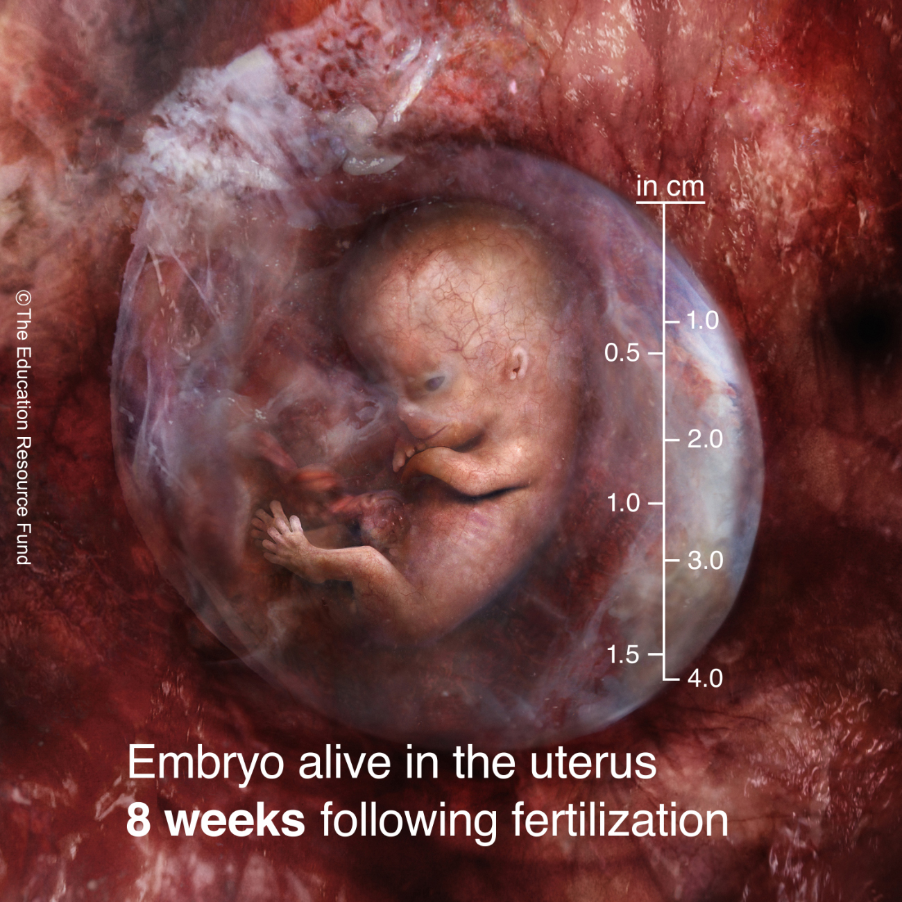 Embryo alive in the uterus 8 weeks following fertilization