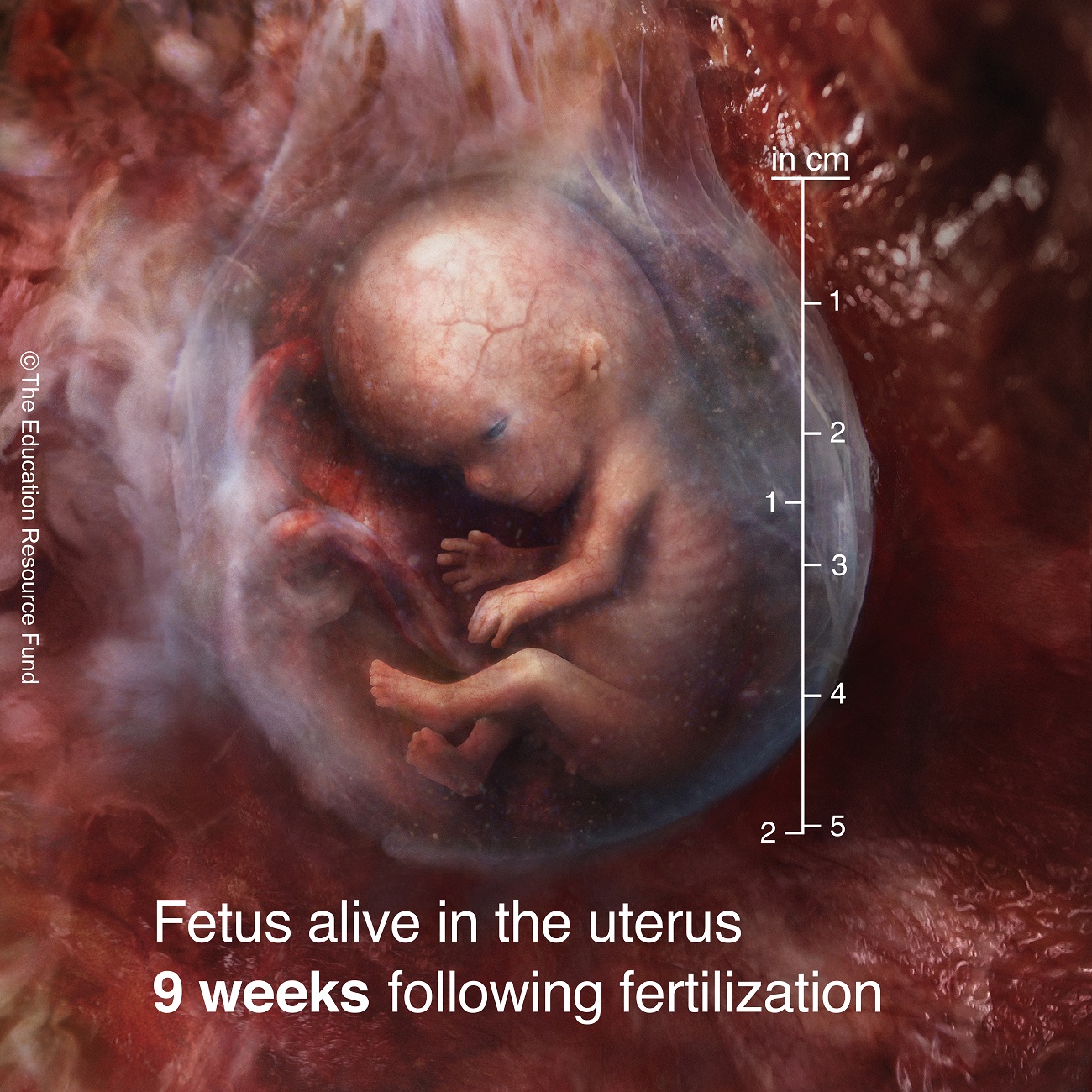 Fetus alive in the uterus 9 weeks following fertilization