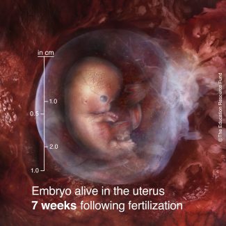 Embryo alive in the uterus 7 weeks following fertilization