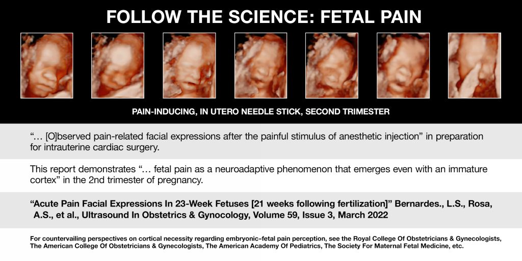 Follow the Science: Fetal pain as a neuroadaptive phenomenon that emerges even with an immature cortex