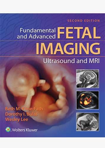 fetal imaging
