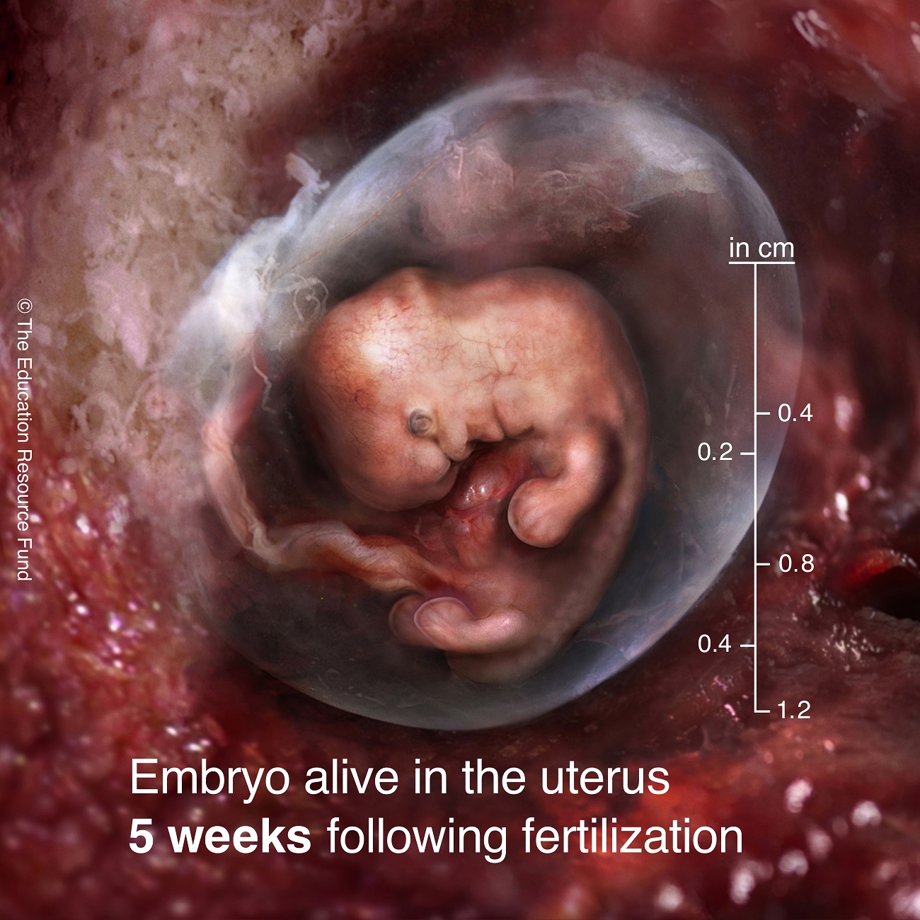 Embryo alive in the uterus 5 weeks following fertilization