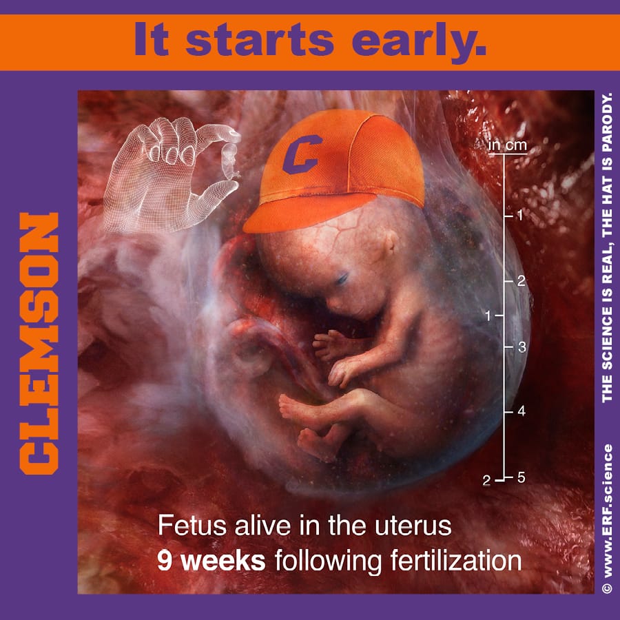 Fetus alive in the uterus 9 weeks following fertilization