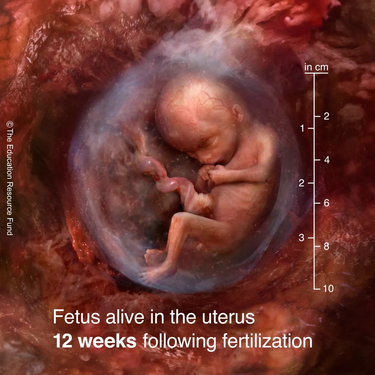 Fetus alive in the uterus 12 weeks following fertilization