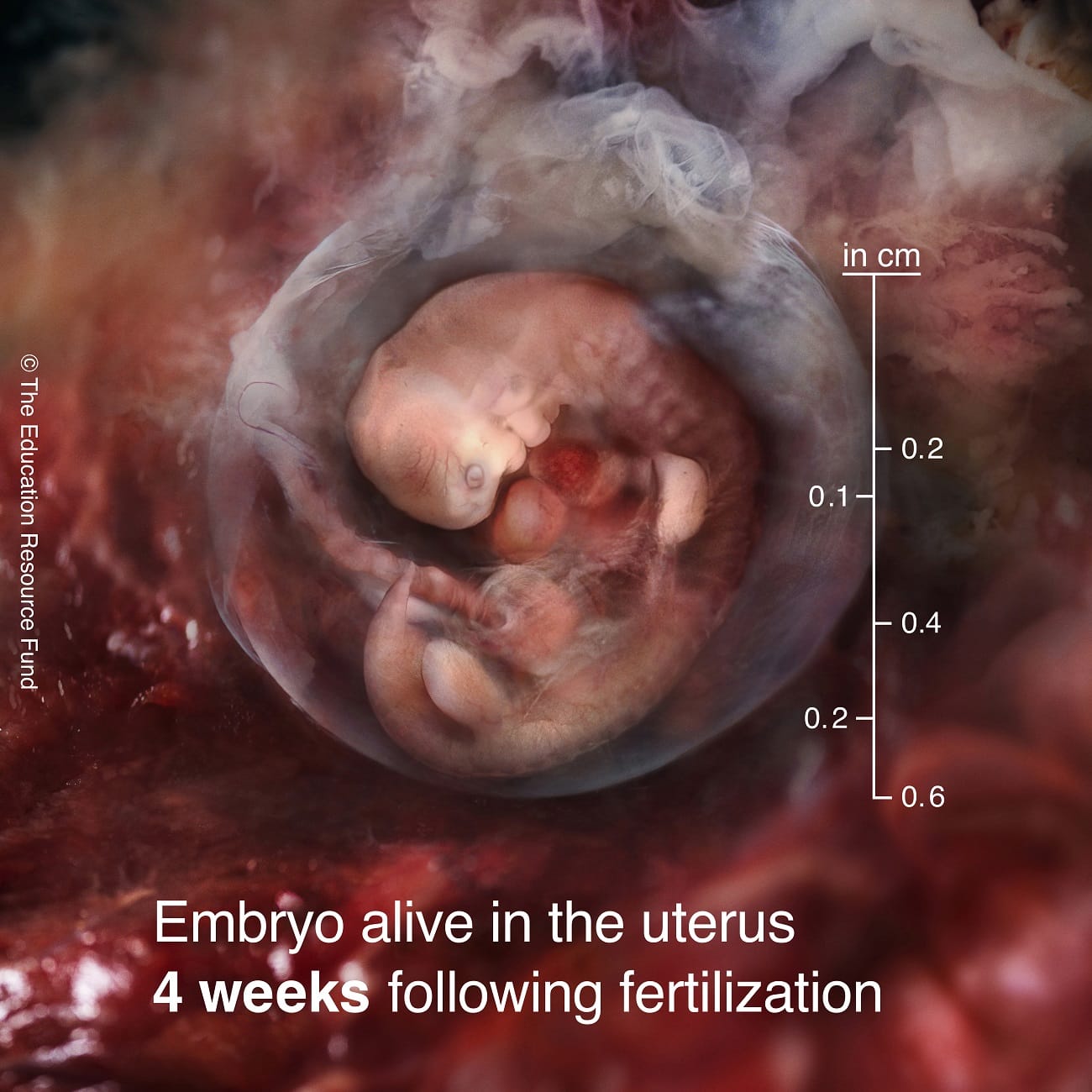Embryo alive in the uterus 4 weeks following fertilization
