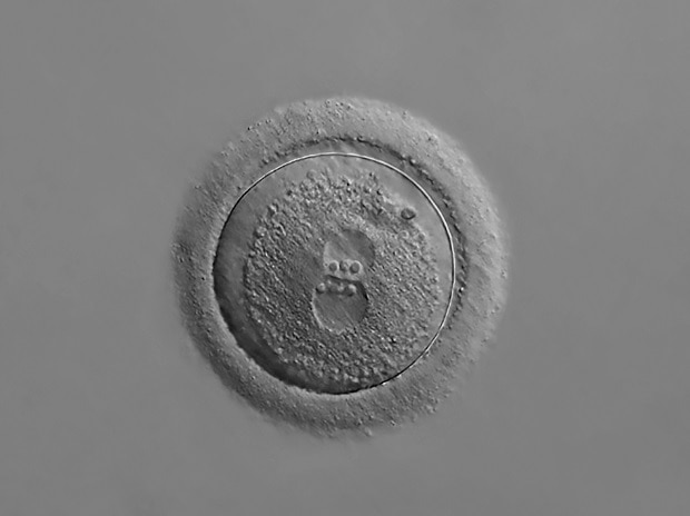 Photomicrograph Of An Isolated Human Zygote With Two Pronucle 20x_1