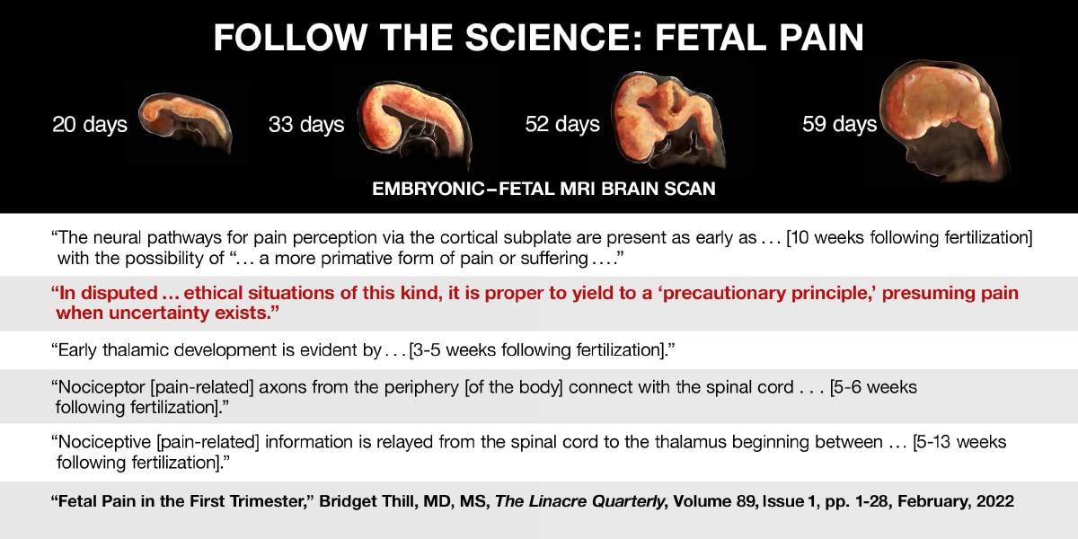 Fetal Pain 1
