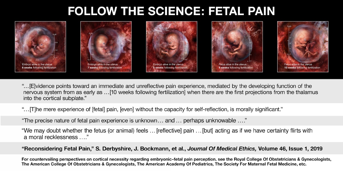 Fetal Pain 3