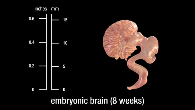8 week embryonic brain