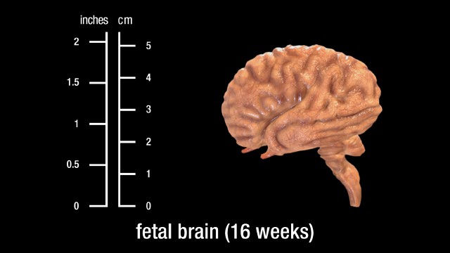 16 week fetal brain