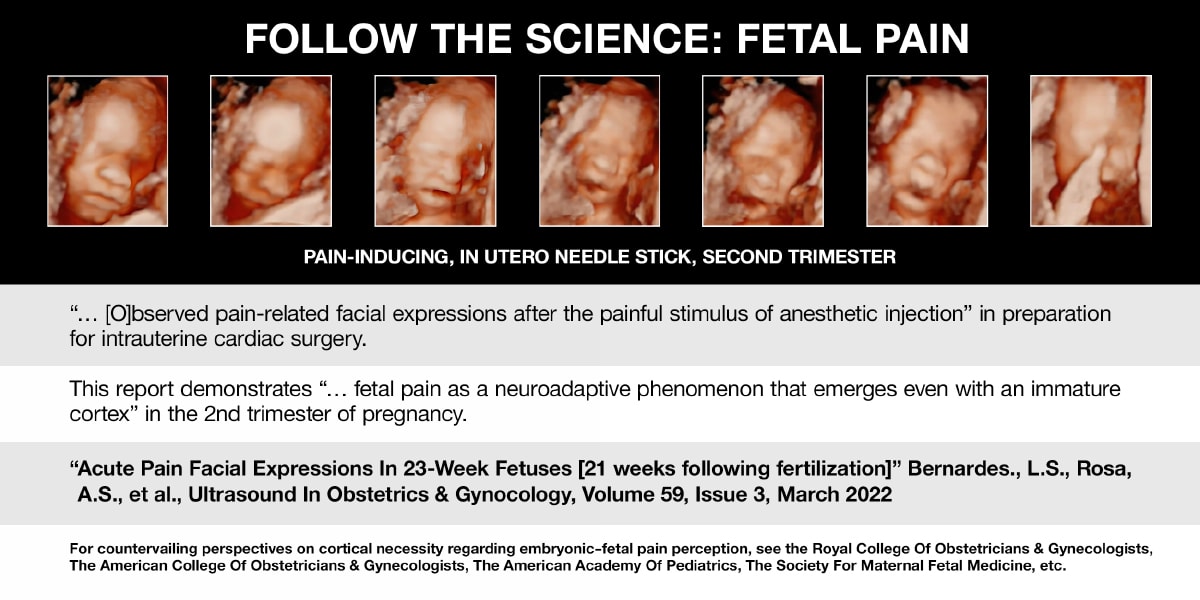 Fetal Pain 5