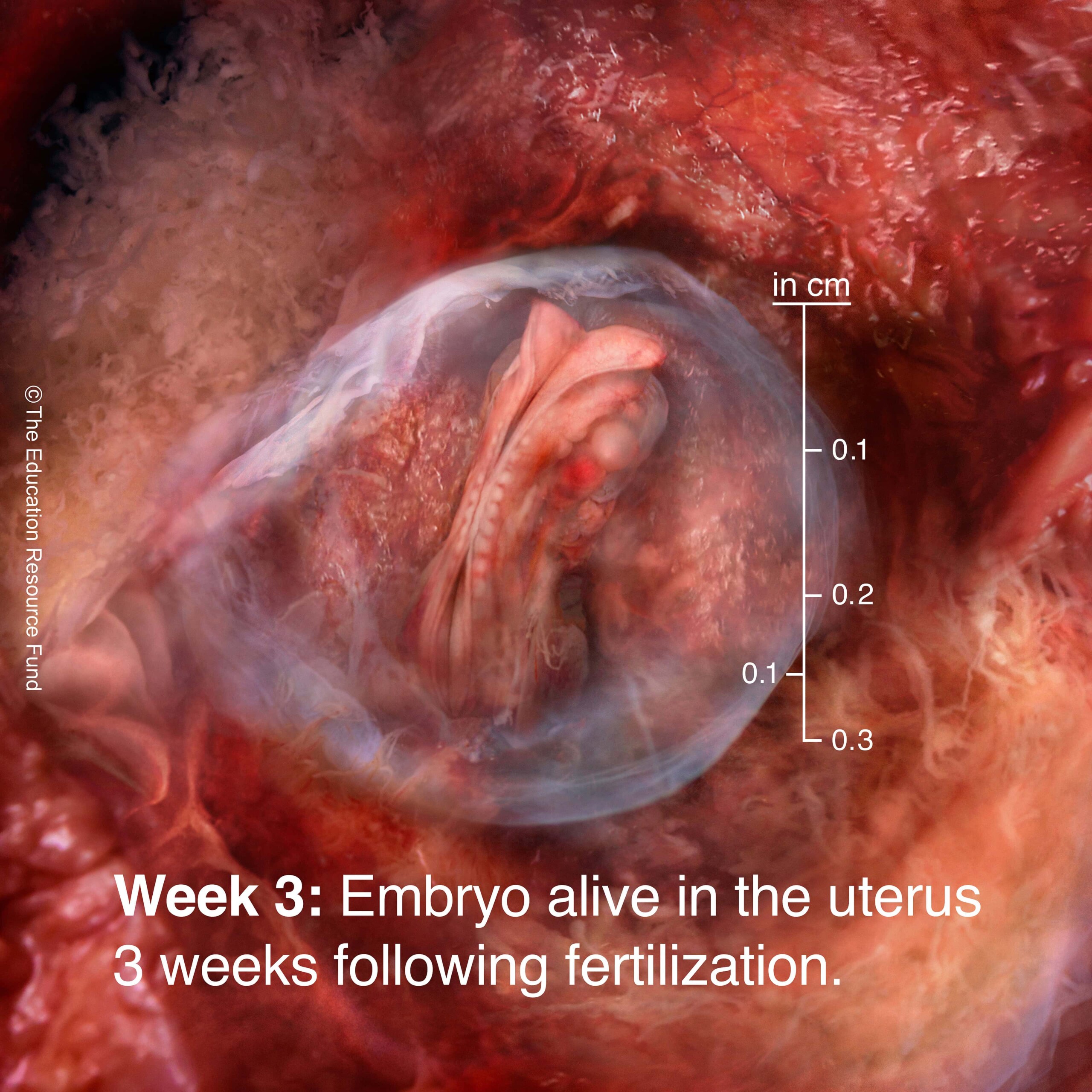 Week 3: Embryo alive in the uterus 3 weeks following fertilization
