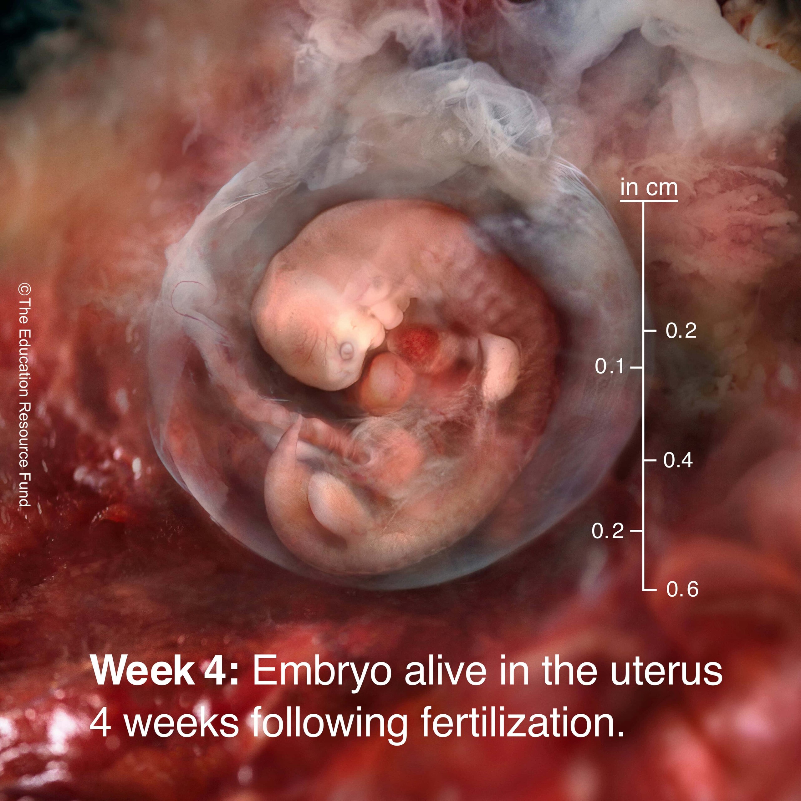 Week 4: Embryo alive in the uterus 4 weeks following fertilization