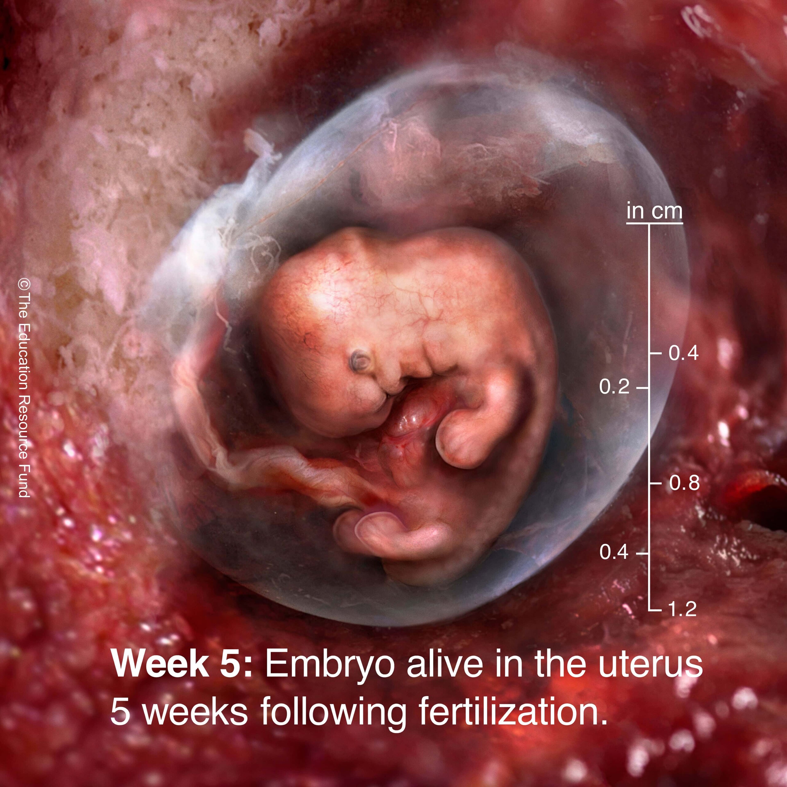 Week 5: Embryo alive in the uterus 5 weeks following fertilization