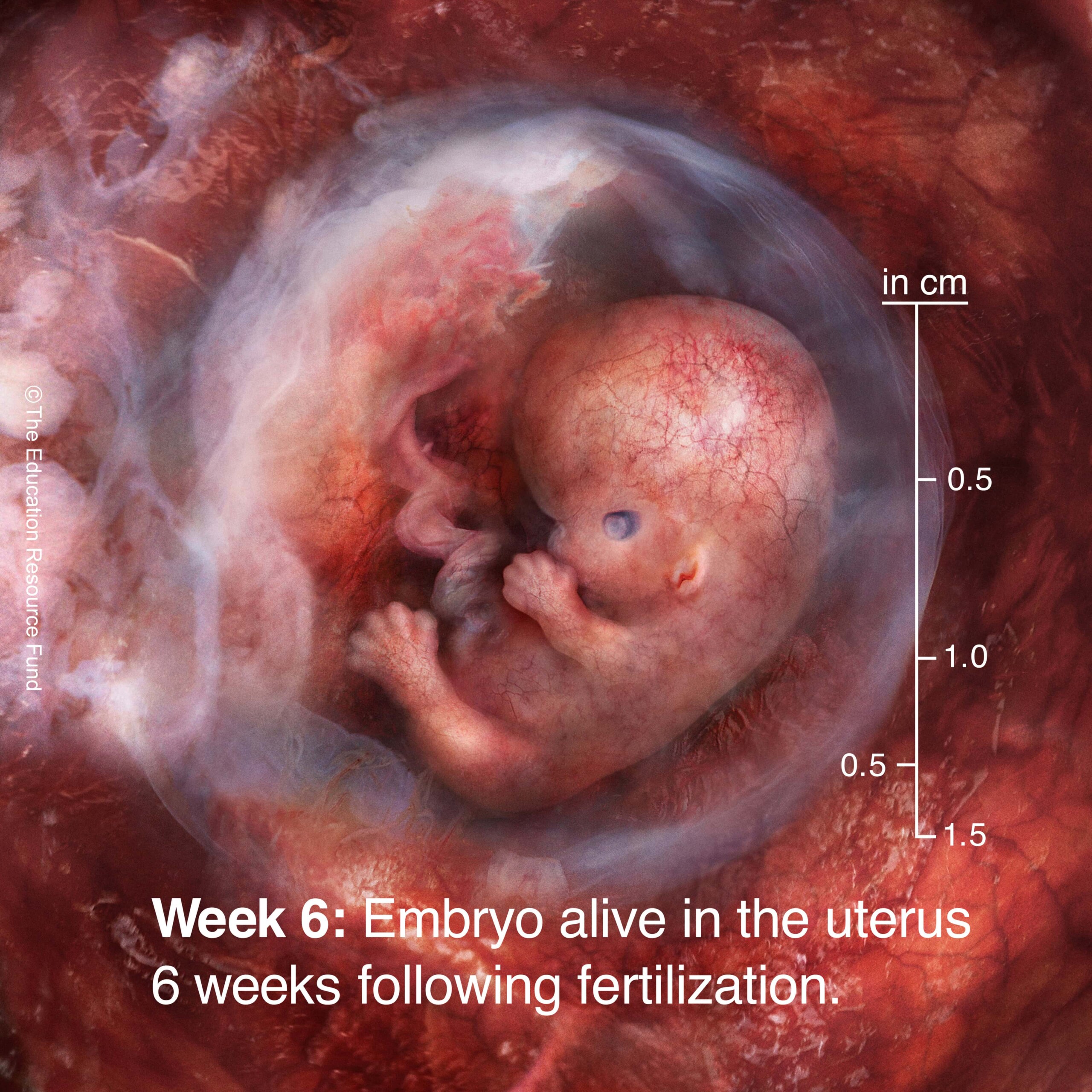 Week 6: Embryo alive in the uterus 6 weeks following fertilization