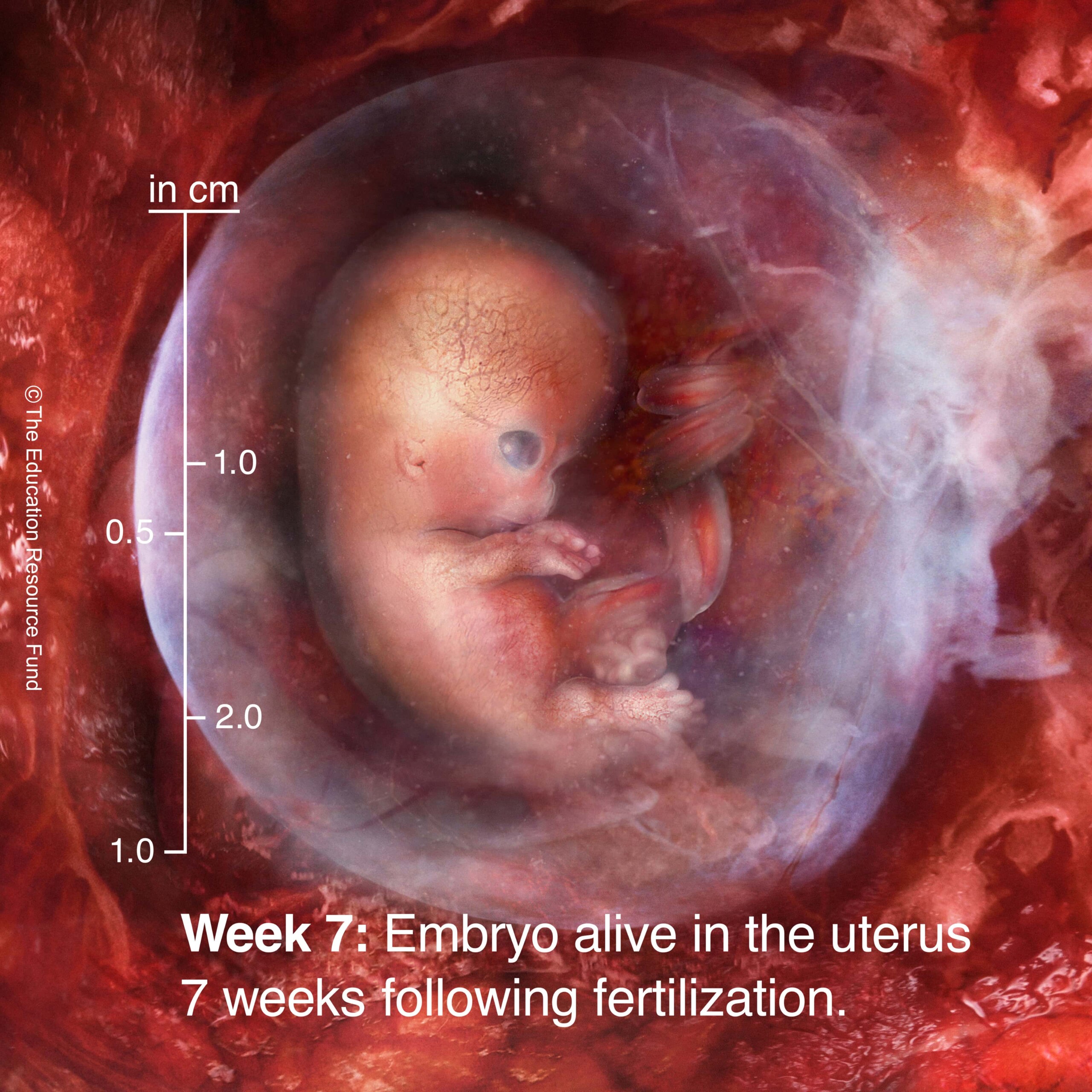 Week 7: Embryo alive in the uterus 7 weeks following fertilization