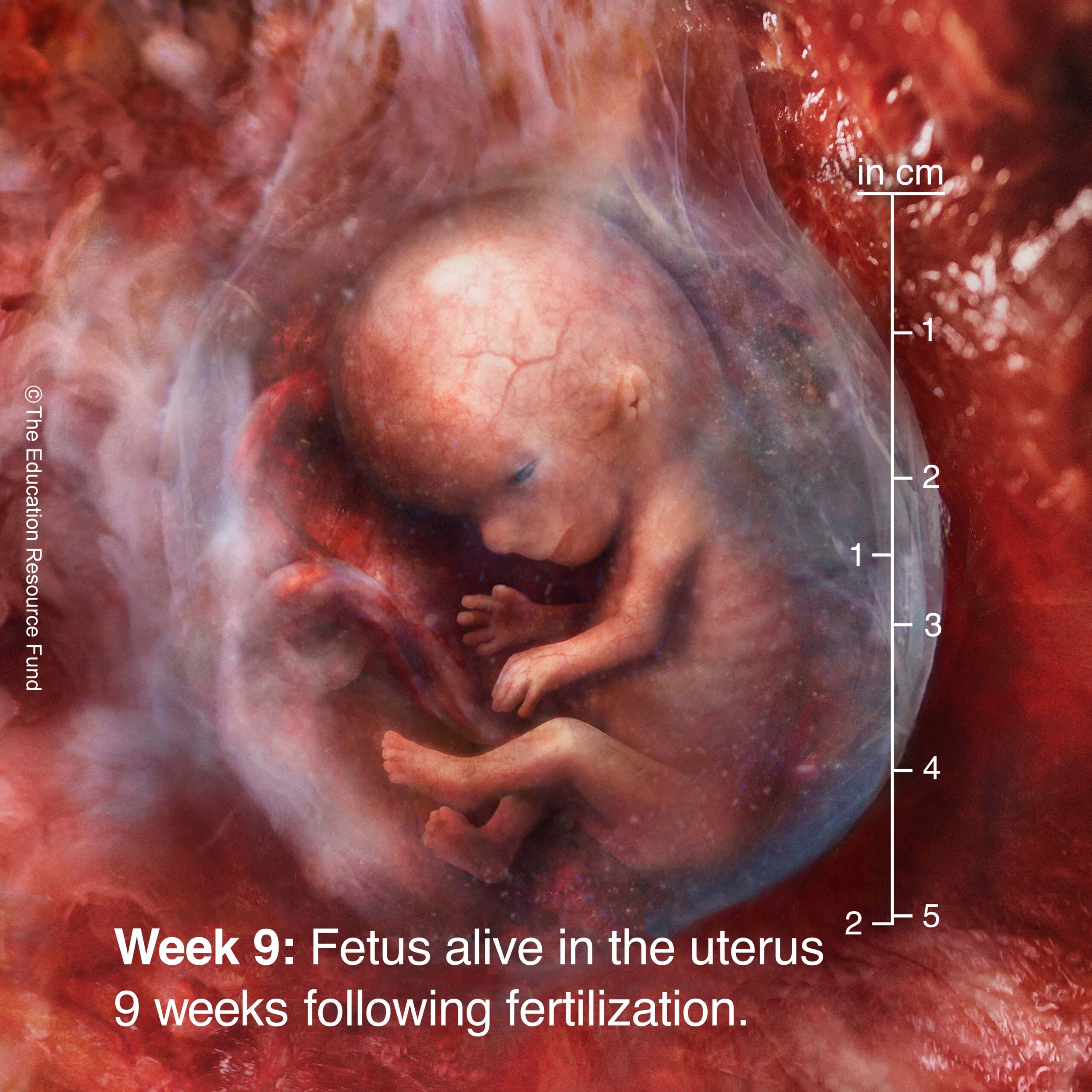 Week 9: Embryo alive in the uterus 9 weeks following fertilization