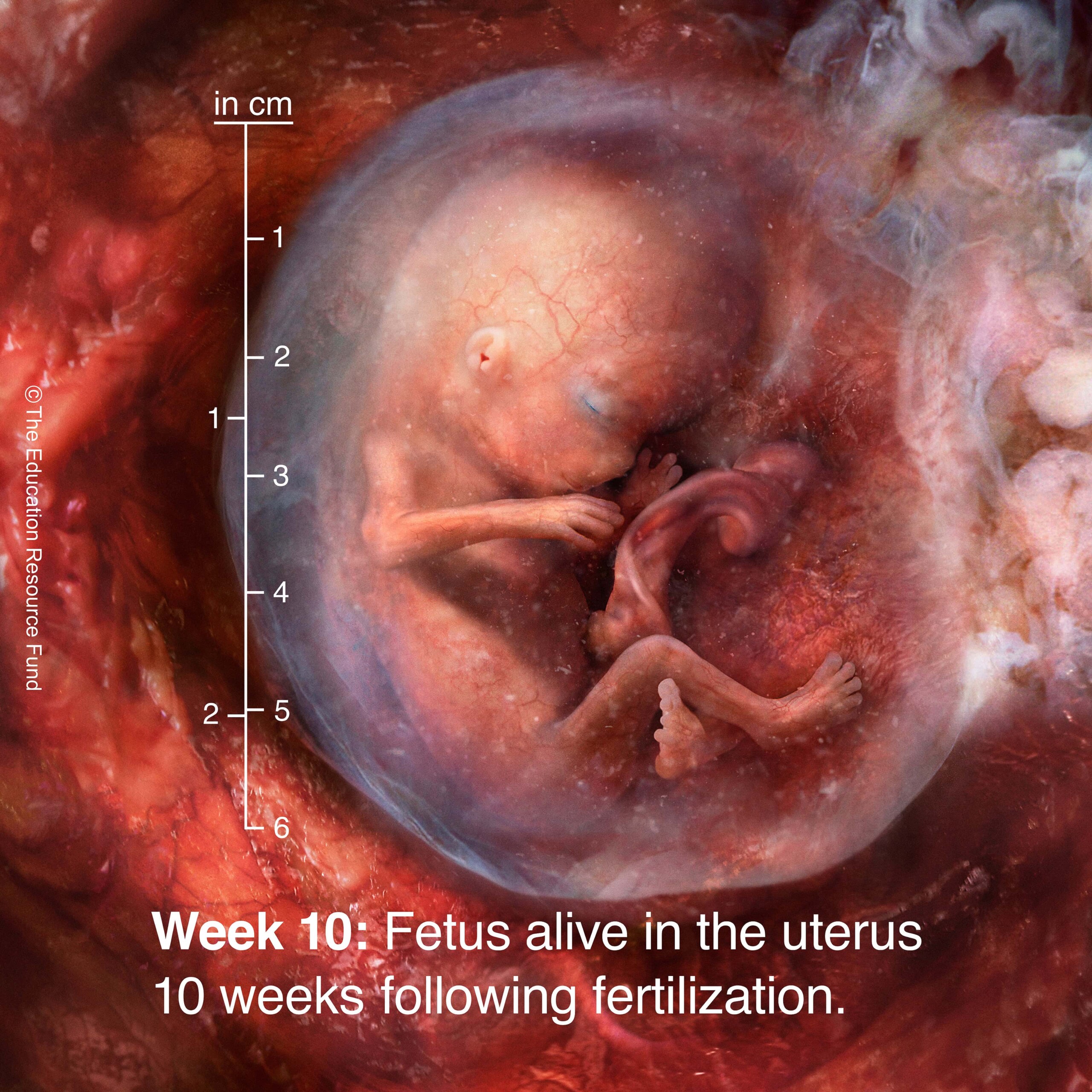 Week 10: Embryo alive in the uterus 10 weeks following fertilization