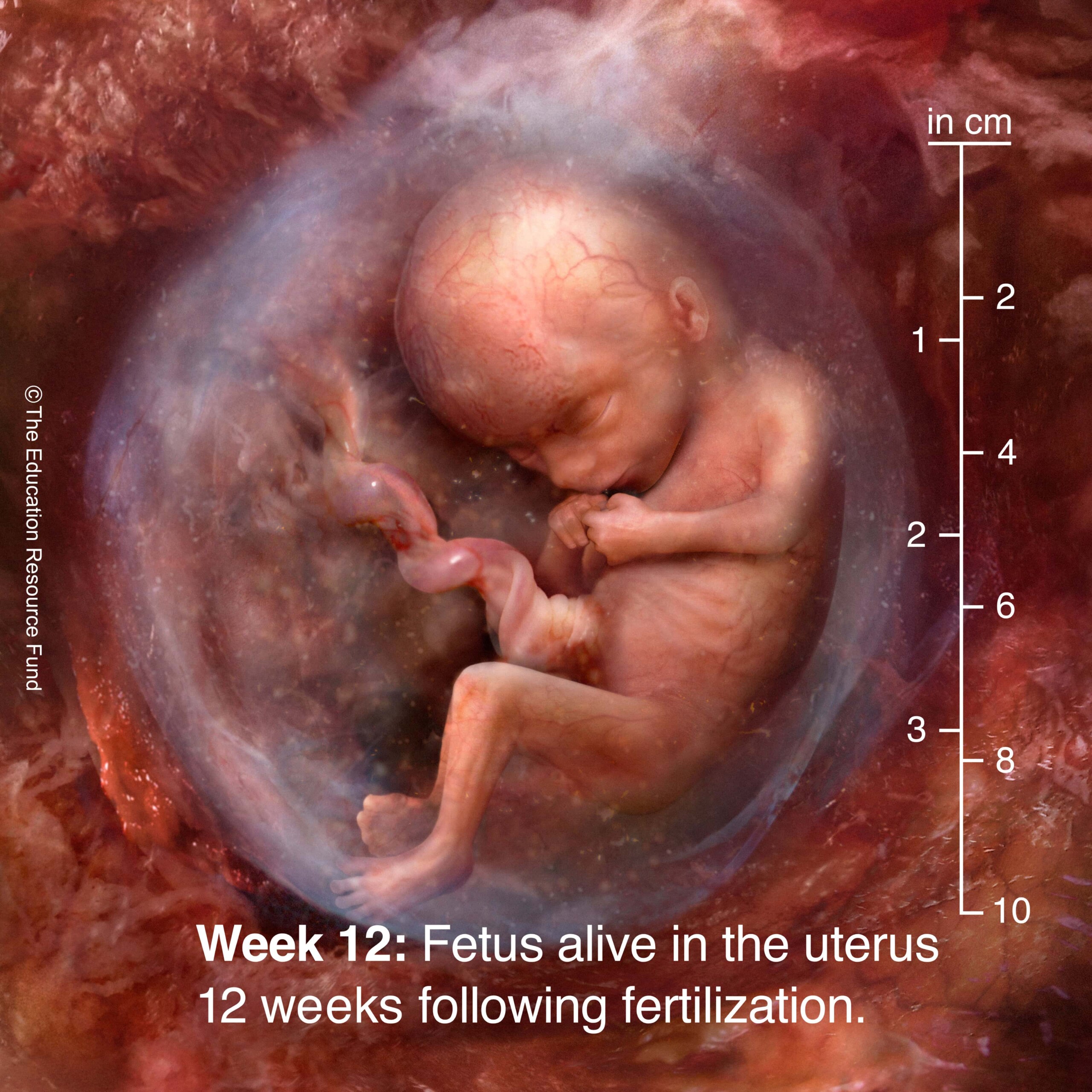 Week 12: Embryo alive in the uterus 12 weeks following fertilization