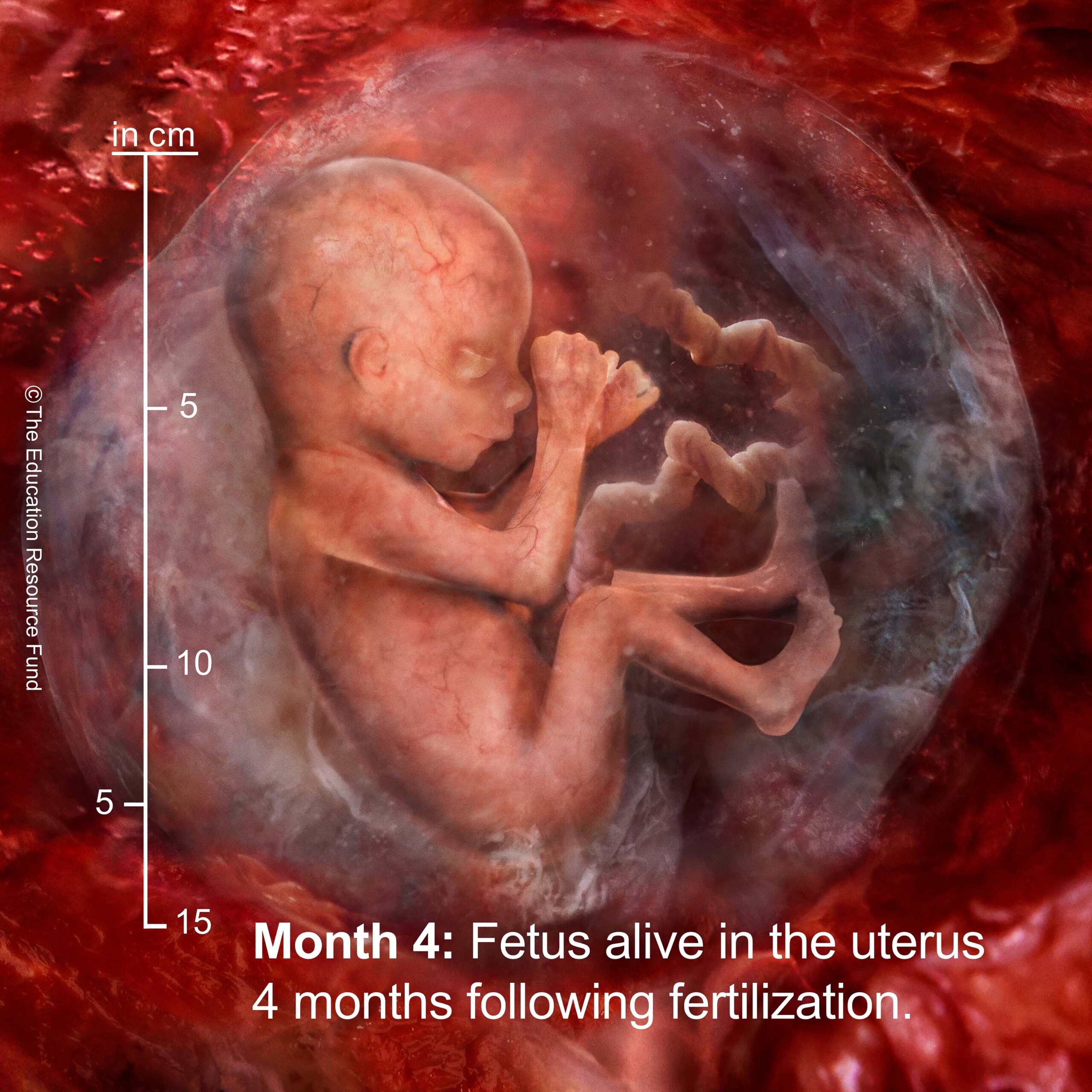 Month 4: Embryo alive in the uterus 4 months following fertilization
