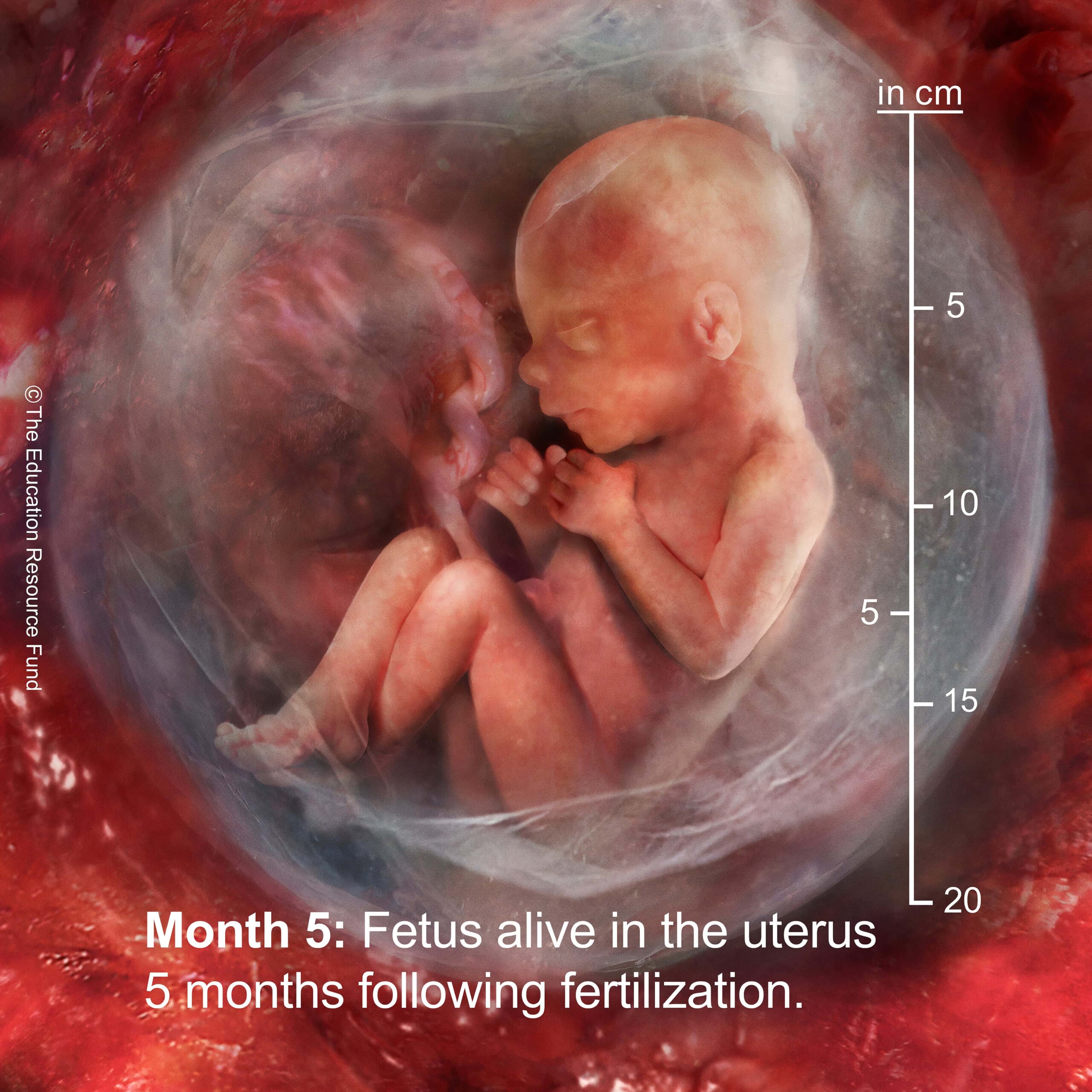 Month 5: Embryo alive in the uterus 5 months following fertilization