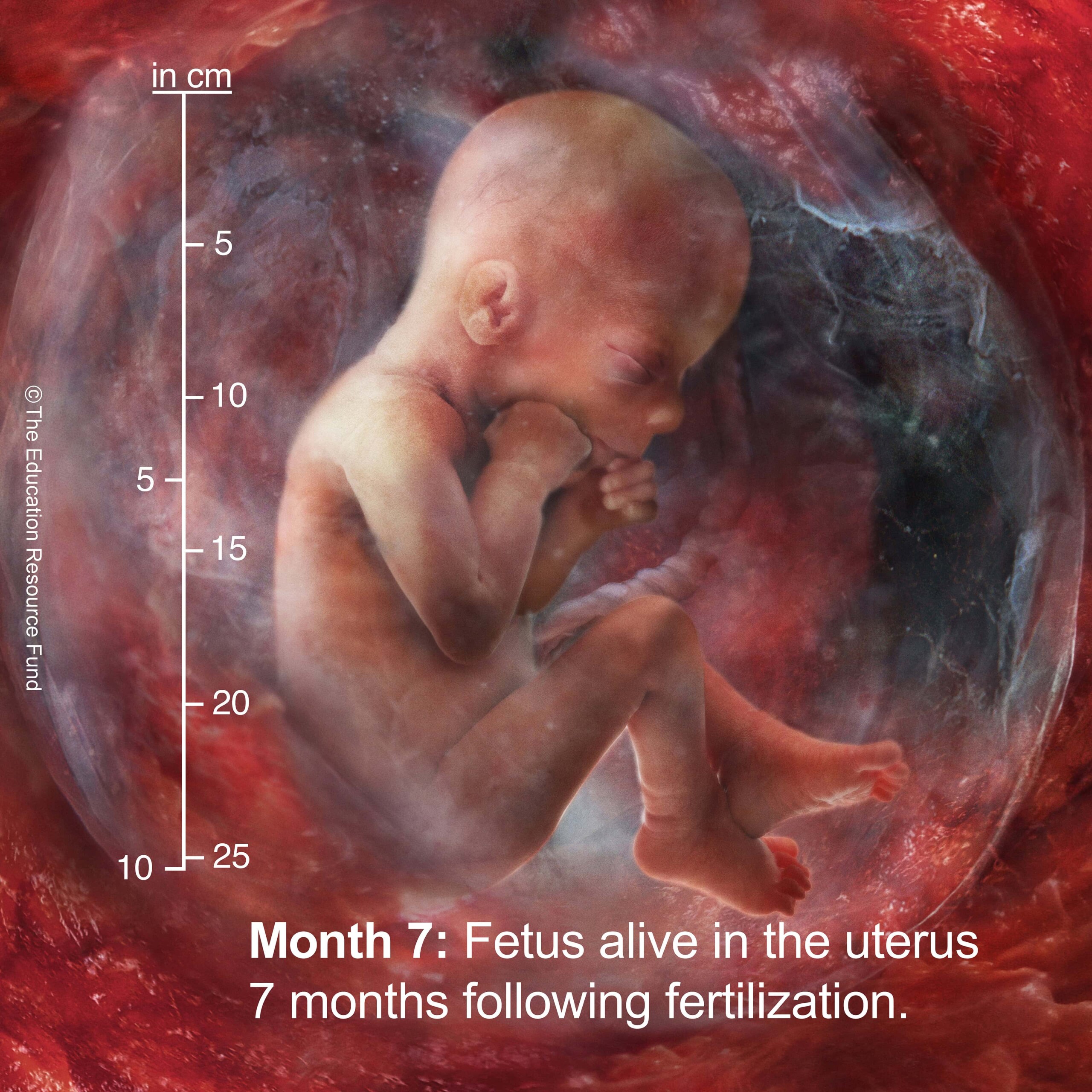 Month 7: Embryo alive in the uterus 7 months following fertilization