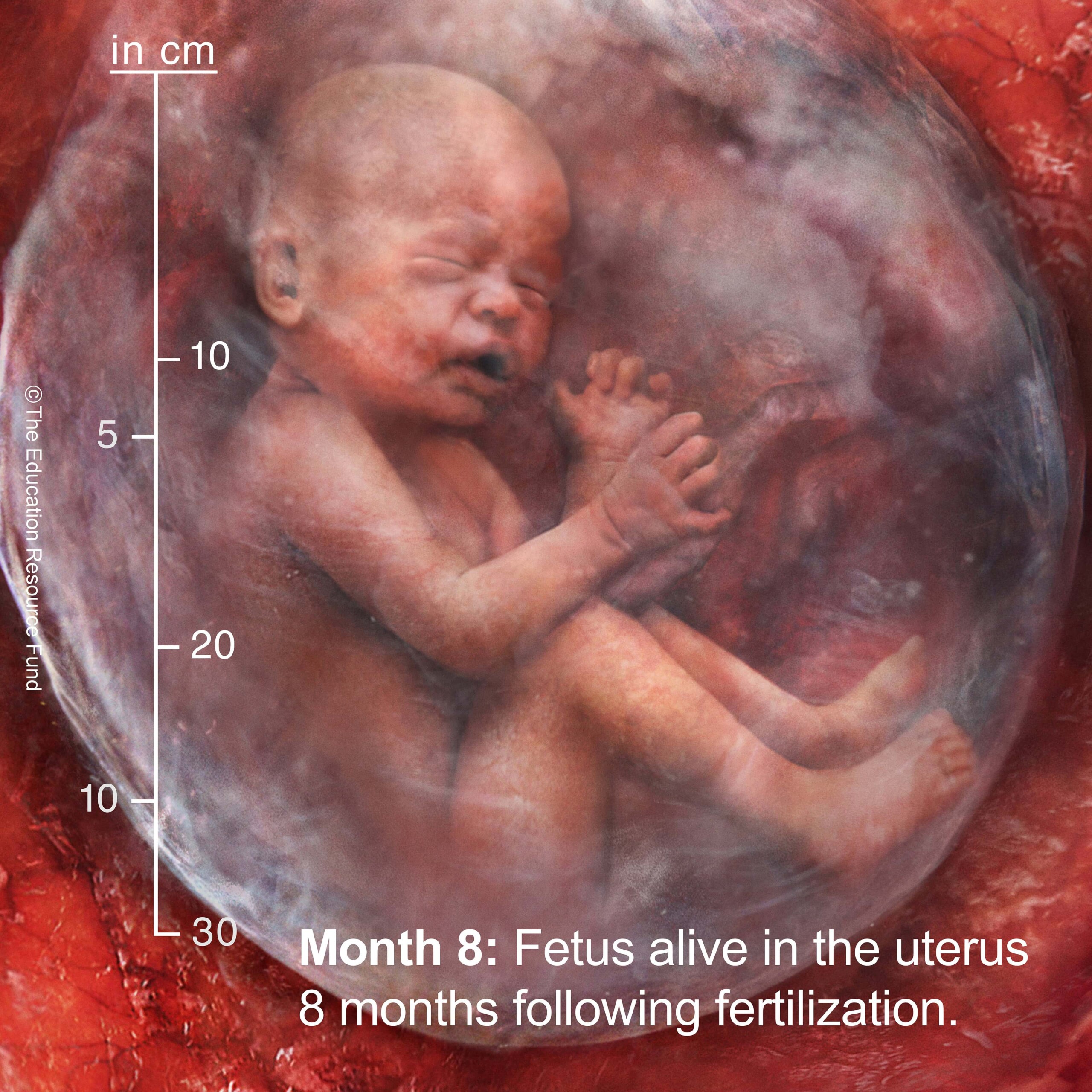 Month 8: Embryo alive in the uterus 8 months following fertilization